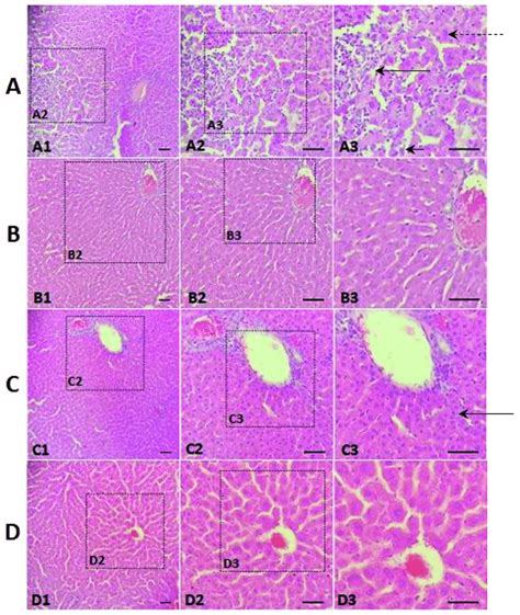 Photomicrographs of histological sections of hepatic tissue, stained... | Download Scientific ...