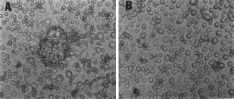 M. abscessus-R infection of human monocytes is associated with the... | Download Scientific Diagram