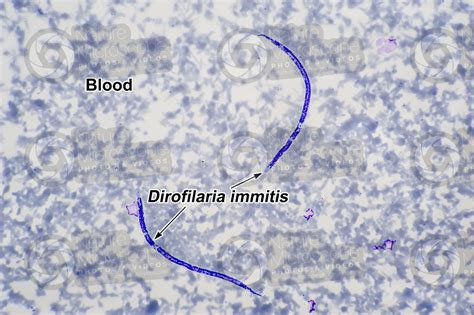 Dirofilaria immitis. Dirofilariasis. 250X - Nematoda (Nematodes ...