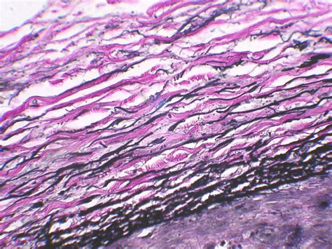 Elastic Tissue - Histology Control Systems, Inc