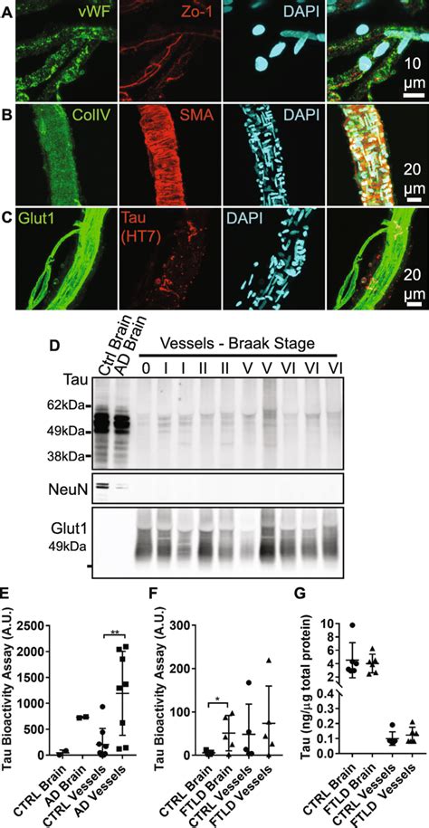 Tau protein in human vasculature. a Blood vessel isolations containing ...