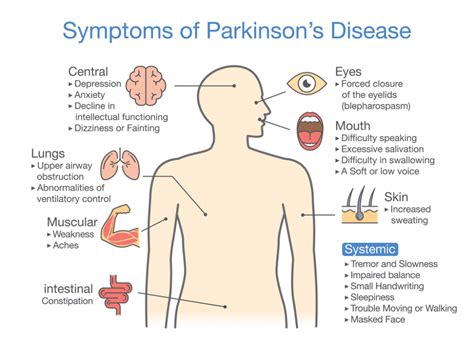 FAQS on Parkinson's Disease % - HOSIPED