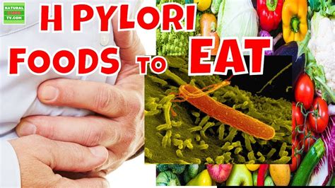 11 H Pylori Foods To Eat (And To Avoid) Hollywood Homestead, 54% OFF