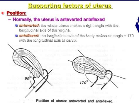 Retroverted retroflexed uterus &uterine inversion