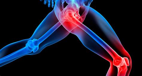 Leg Pain - What Does it Mean? | Granite Chiropractic