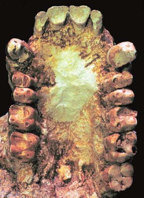 Ouranopithecus maxilla XIR-1, a worn maxillary dentition with canines ...