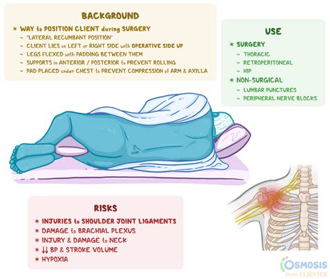 Lateral Position: What Is It, Uses, and More | Osmosis