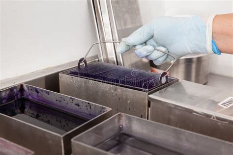 Scientist Staining Microscope Slides for Cytology Studies in the Laboratory Stock Photo - Image ...