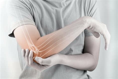 Best Complex Fractures Doctor in Hyderabad | Surgery for complex fractures