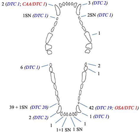 | Histologic representation of a typical dentigerous cyst from one of... | Download Scientific ...