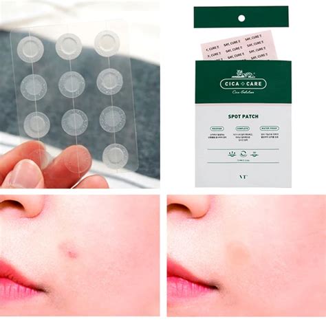 12 Patches Face Spot Scar Care Acne Pimple Master Patch Treatment Sticker Anti Infection Pimple ...