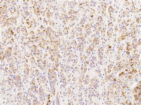 MCP-1 Antibody (PA5-80413)