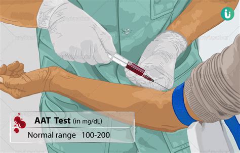 Alpha-1 antitrypsin (AAT) Test: Procedure, Purpose, Results, Normal Range, Cost, Price, Online ...