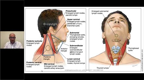 Cancerous Cyst On Neck