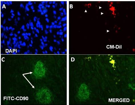 Immunofluorescence photomicrographs showing CD90 expression. Sections... | Download Scientific ...