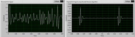 Snap shots of denoised ECG signal after using WA Detrend algorithm and... | Download Scientific ...