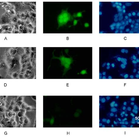 (PDF) Syncytin-A Mediates the Formation of Syncytiotrophoblast Involved in Mouse Placental ...