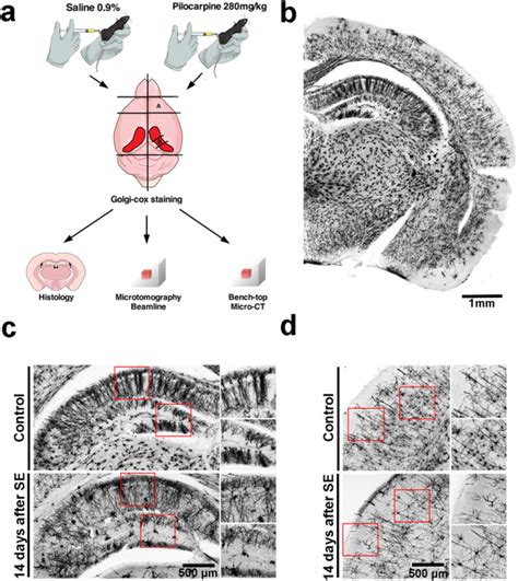 High-resolution synchrotron-based X-ray microtomography as a tool to unveil the three ...