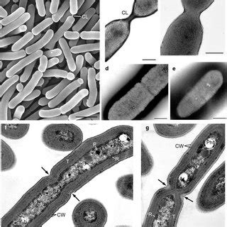 (PDF) The pleiotropic effects of ftn2 and ftn6 mutations in cyanobacterium Synechococcus sp. PCC ...