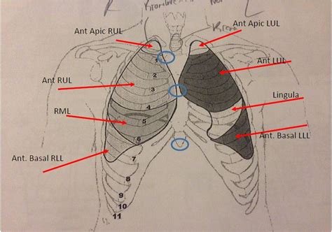 Lung Segments of the Anterior Chest Wall chest auscultation points ...