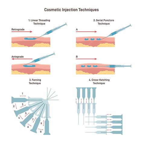 Premium Vector | Cosmetic injection technique set filler hyaluronic acid facial injection