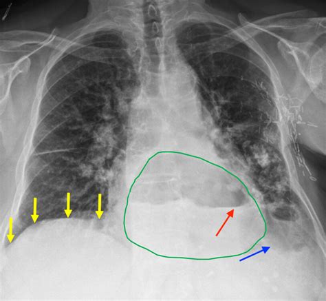 RT 303 Chest Radiographs Game! Jeopardy Template