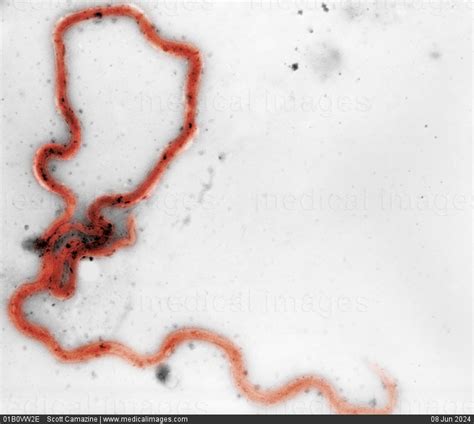 STOCK IMAGE, treponema pallidum shown under dark field light microscopy treponema is a gram ...