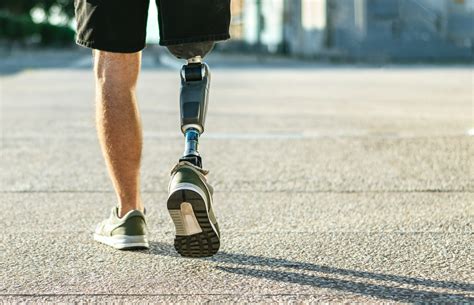 Helping the body and brain to welcome bionic limbs and implants – Horizon Magazine Blog