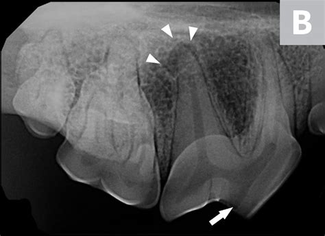 Interpreting Dental Radiographs | Clinician's Brief