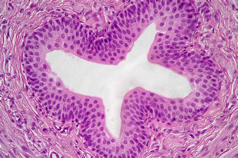 Transitional Epithelium