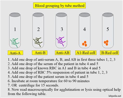 Blood banking:- part 1- Blood Groups ABO and Rh System, Blood Grouping Procedures - Labpedia.net