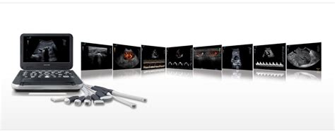 The Top Benefits of Using a Portable Ultrasound