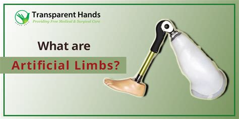 What are Artificial Limbs? | Healthcare for disabled persons