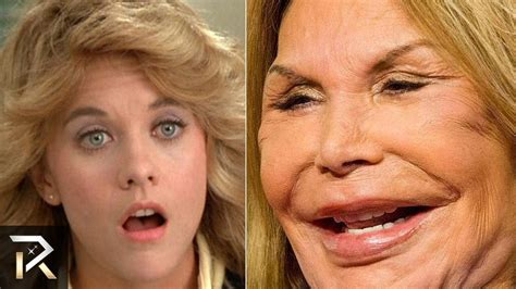 Famous People Who Are Unrecognizable Today (With images) | Bad ...