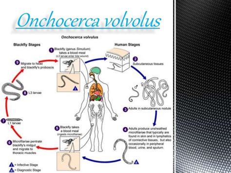 Onchocerca volvulus