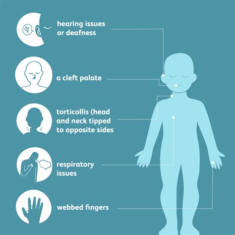 Klippel-Feil Syndrome: Symptoms, Causes, Diagnosis, and Treatment