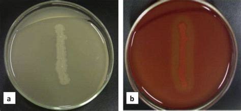 Geobacillus stearothermophilus - Alchetron, the free social encyclopedia