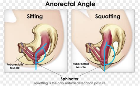 Toilet Squatting Position Defecation Postures Feces Squat PNG Image - PNGHERO