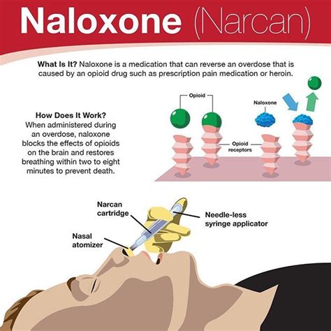 Narcan infographic #design #narcan #naloxone #infographic | Emergency ...