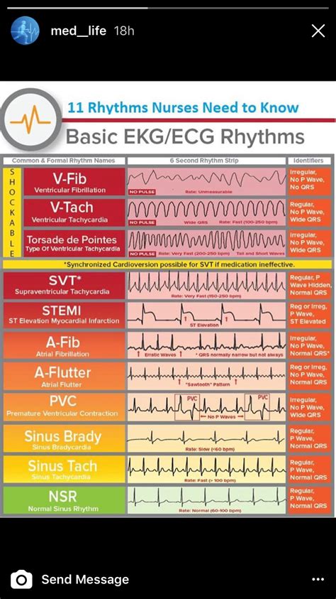 Pin by Rosie D. 🌹 on Nursing Study Guide! | Nurse, Nursing school ...