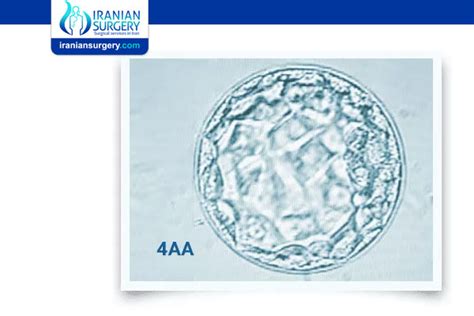 Embryo Grading Chart | Success Rates by Grade