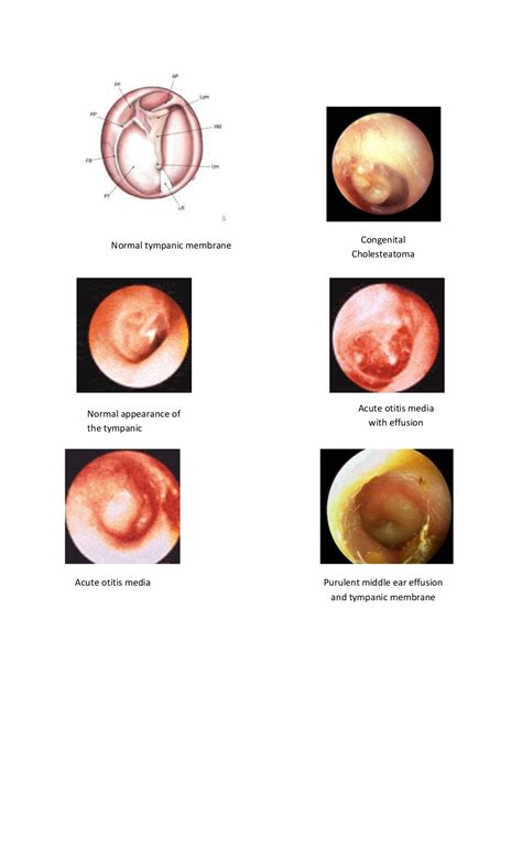 Tympanic membrane dr. fadil