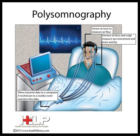 Polysomnography Brain Activities, Scalps, Disorders, Sensor, Data, Movement, Nose, Sleep, Health