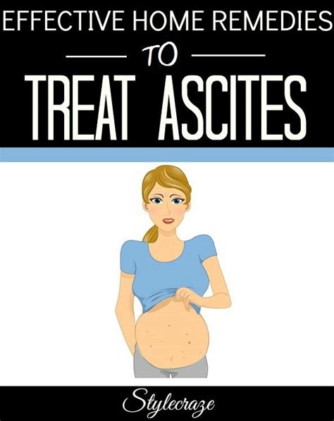 Ascites Causes Pictures Symptoms And Treatment