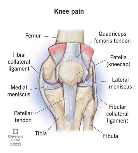 Knee Pain Cause - Ask The Nurse Expert