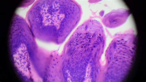 Papilas gustativas | Microscopio | Todos sabemos que a través de la lengua nos llegan los ...