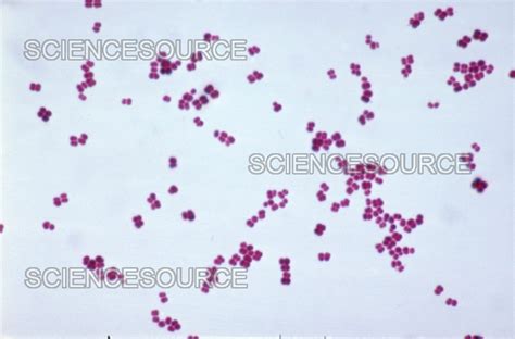 Micrococcus luteus, LM | Stock Image - Science Source Images