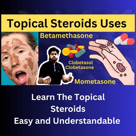 What are Topical Steroids, Uses of Topical Steroids, Side Effects of Topical Steroids || QUIZ ...