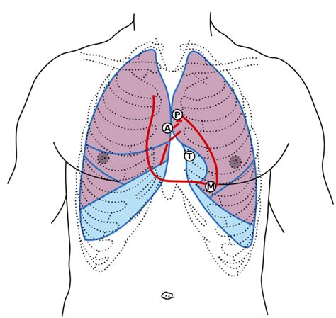 Heart Sounds Diagram