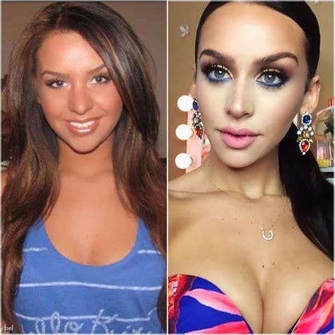 10 Popular Instagram Models Before And After Cosmetic Surgery ...